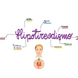 Hipotireodismo